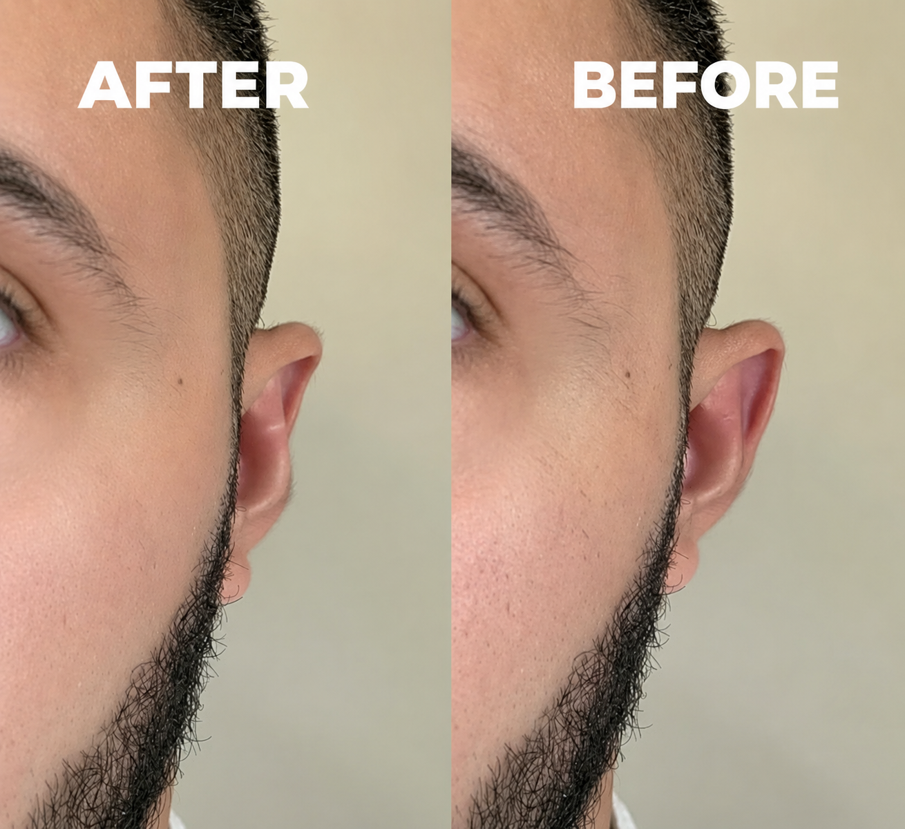 Earluqs™ Ear-Shaping Clip